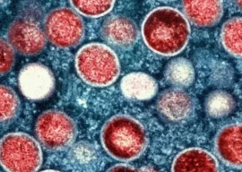 what is mpox everything to know about the virus declared a global health emergency what is mpox everything to know about the virus declared a global health emergency